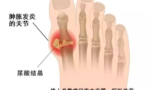 糖尿病能吃菜瓜含糖量-糖尿病人能菜瓜可以吗-专业糖尿病人吃菜瓜升血糖吗平台-糖尿病患者可以吃菜瓜吗